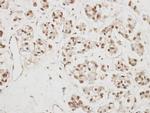 NCBP1 Antibody in Immunohistochemistry (Paraffin) (IHC (P))