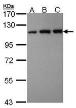 VDP Antibody in Western Blot (WB)