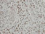 TRIP15 Antibody in Immunohistochemistry (Paraffin) (IHC (P))