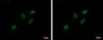 MTA2 Antibody in Immunocytochemistry (ICC/IF)