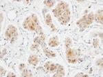 DLC1 Antibody in Immunohistochemistry (Paraffin) (IHC (P))