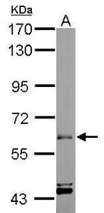 ARIH2 Antibody in Western Blot (WB)