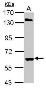 ARIH2 Antibody in Western Blot (WB)