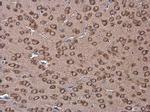 Coronin 1A Antibody in Immunohistochemistry (Paraffin) (IHC (P))