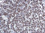 GGA3 Antibody in Immunohistochemistry (Paraffin) (IHC (P))