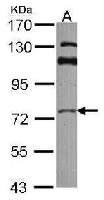 GGA3 Antibody in Western Blot (WB)