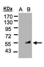 FLVCR1 Antibody in Western Blot (WB)