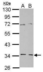 GGPS1 Antibody in Western Blot (WB)