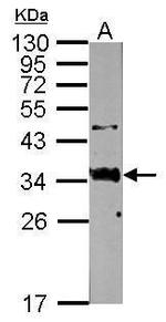 SFTPA1 Antibody in Western Blot (WB)