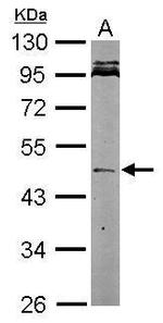 Nodal Antibody in Western Blot (WB)