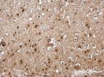 SKP1 Antibody in Immunohistochemistry (Paraffin) (IHC (P))