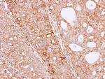 THUMPD3 Antibody in Immunohistochemistry (Paraffin) (IHC (P))