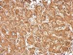 HACL1 Antibody in Immunohistochemistry (Paraffin) (IHC (P))