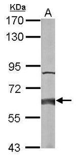 HACL1 Antibody in Western Blot (WB)