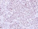 RCC2 Antibody in Immunohistochemistry (Paraffin) (IHC (P))