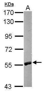 RCC2 Antibody in Western Blot (WB)