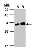 Latexin Antibody in Western Blot (WB)