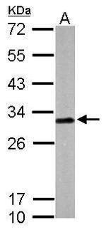 Latexin Antibody in Western Blot (WB)