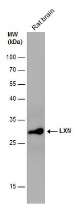 Latexin Antibody in Western Blot (WB)