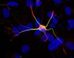 Doublecortin Antibody in Immunocytochemistry (ICC/IF)