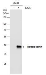 Doublecortin Antibody in Western Blot (WB)