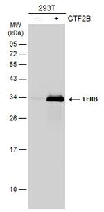 GTF2B Antibody in Western Blot (WB)