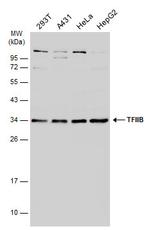 GTF2B Antibody in Western Blot (WB)