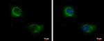 KRT71 Antibody in Immunocytochemistry (ICC/IF)