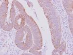 KRT71 Antibody in Immunohistochemistry (Paraffin) (IHC (P))