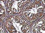 FIP200 Antibody in Immunohistochemistry (Paraffin) (IHC (P))