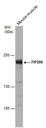 FIP200 Antibody in Western Blot (WB)