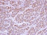 AGK Antibody in Immunohistochemistry (Paraffin) (IHC (P))