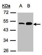 AGK Antibody in Western Blot (WB)