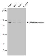 PI4KA Antibody in Western Blot (WB)