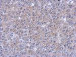 Syk Antibody in Immunohistochemistry (Paraffin) (IHC (P))