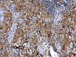 Syk Antibody in Immunohistochemistry (Paraffin) (IHC (P))