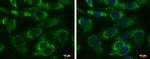 Adenylate Kinase 4 Antibody in Immunocytochemistry (ICC/IF)