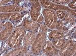 p70 S6 Kinase Antibody in Immunohistochemistry (Paraffin) (IHC (P))