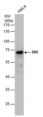 p70 S6 Kinase Antibody in Western Blot (WB)