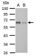 TAB1 Antibody in Western Blot (WB)