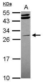 STK16 Antibody in Western Blot (WB)