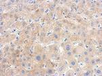 PGK1 Antibody in Immunohistochemistry (Paraffin) (IHC (P))