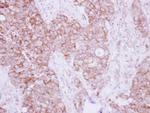 TBRG4 Antibody in Immunohistochemistry (Paraffin) (IHC (P))