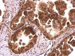 CrkL Antibody in Immunohistochemistry (Paraffin) (IHC (P))