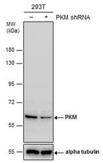 PKM2 Antibody