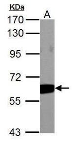 PKM2 Antibody in Western Blot (WB)