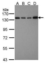 SART3 Antibody in Western Blot (WB)