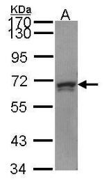 PRPF31 Antibody in Western Blot (WB)