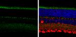 SHANK1 Antibody in Immunohistochemistry (Paraffin) (IHC (P))