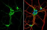 GPR30 Antibody in Immunocytochemistry (ICC/IF)